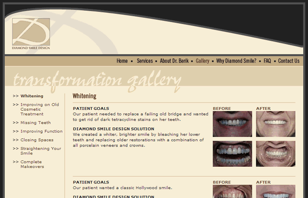 DiamondSmile-Gallery